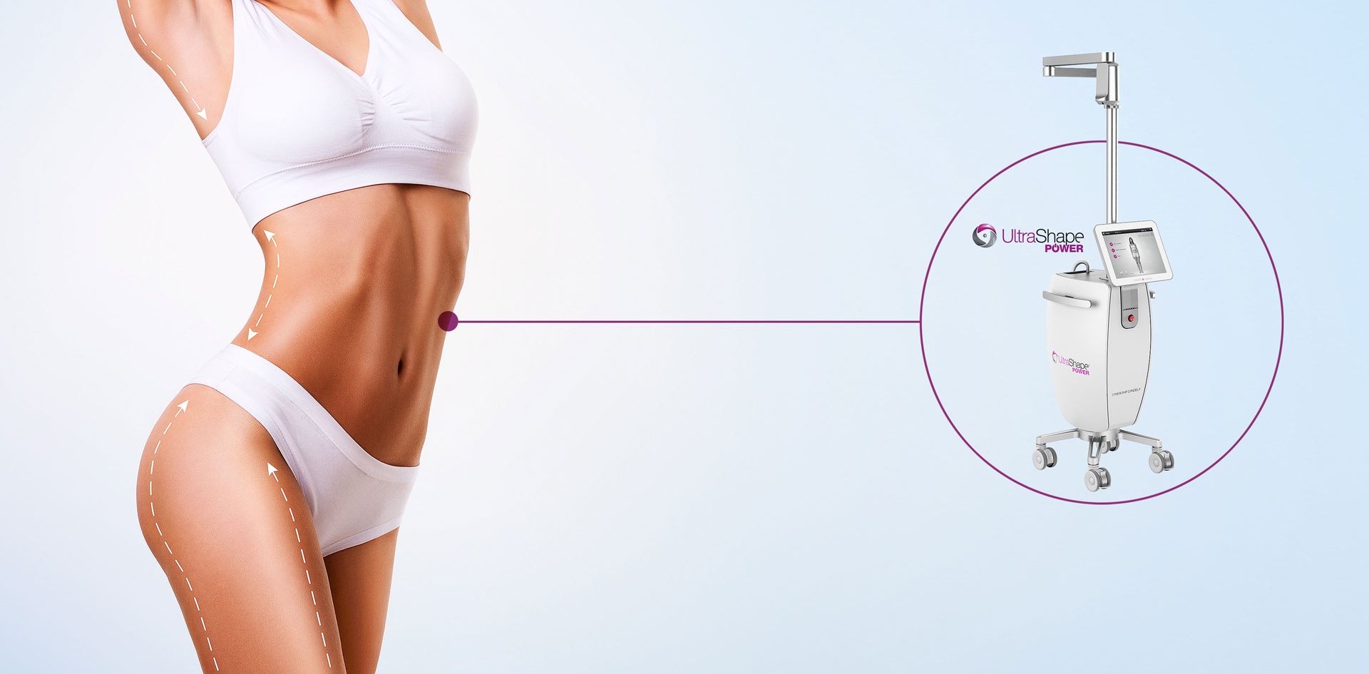 Vela Shape Отзывы Фото До И После