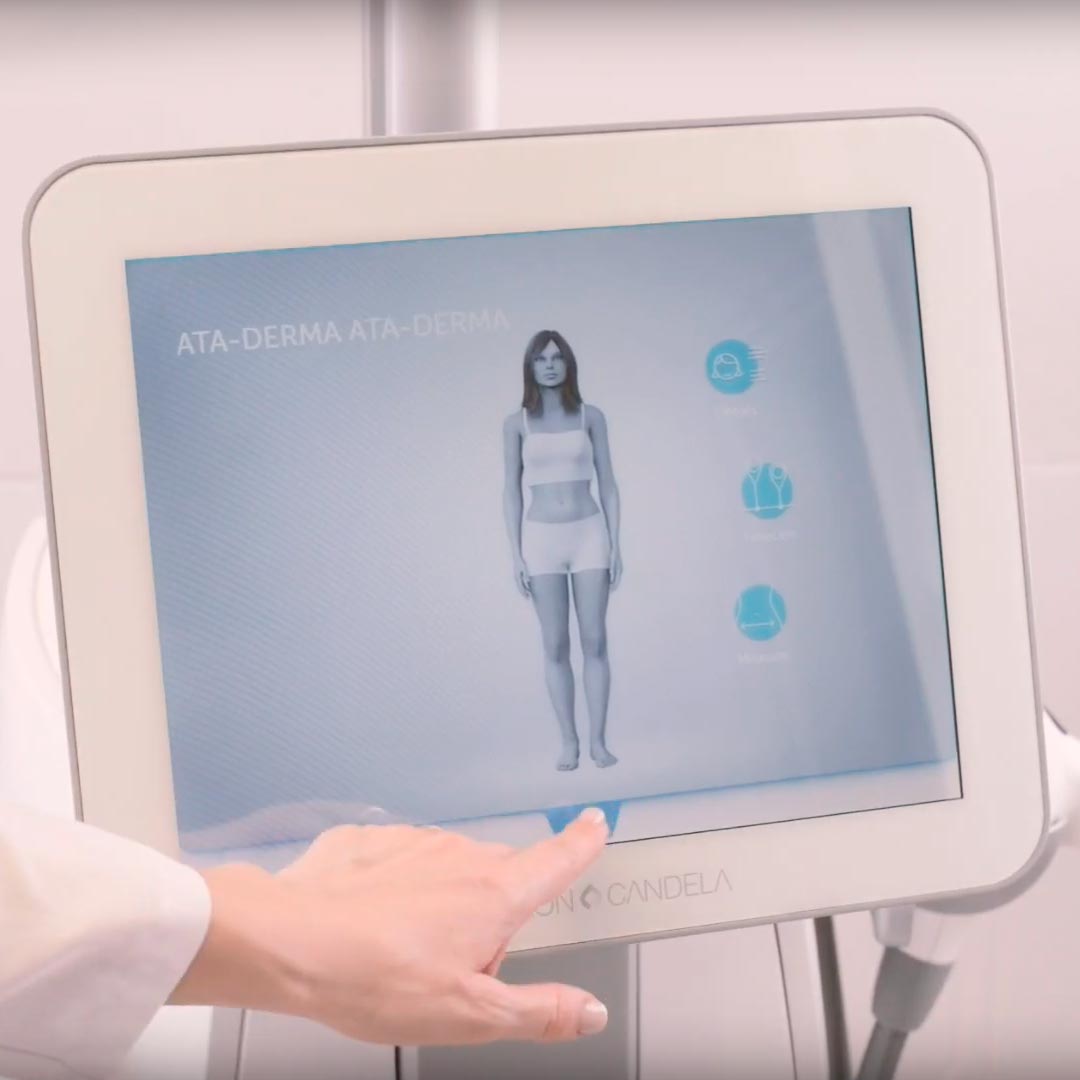 ULTRASHAPE POWER - ултразвуков апарат за разграждане на мастните клетки под кожата ULTRASHAPE POWER - ултразвуков апарат за разграждане на мастните клетки под кожата (снимка)